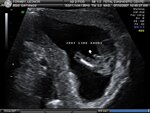 BABY_5.JPG