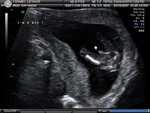 BABY_4.JPG