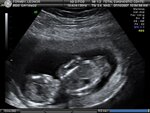 BABY_14.JPG